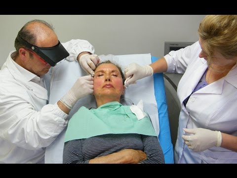 Problemi con borse di stomaco sotto occhi Quali pacchi di faccia possono esser fatti di bacche