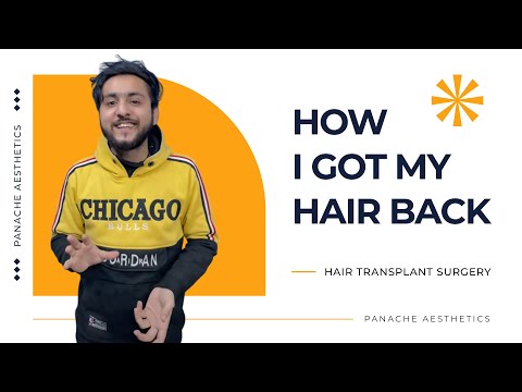 Hair Transplant Patient Review