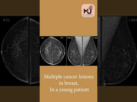 Mammography | MJ Hospital