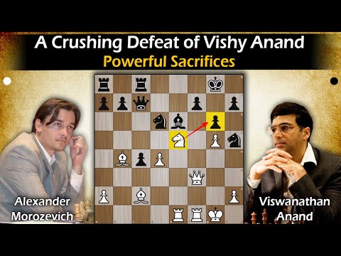 A Crushing Defeat of Vishy Anand | Morozevich vs Anand 1995