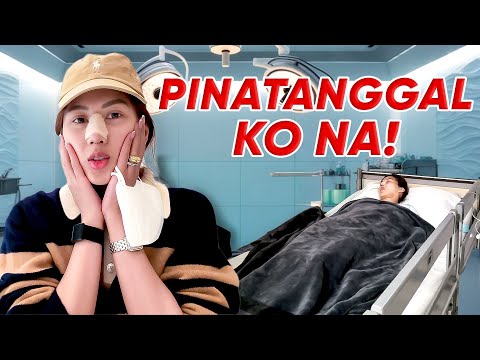 My Rhinoplasty Removal Journey by Alex Gonzaga