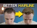 5 POWERFUL Receding Hairline Tricks To INSTANTLY Improve Your Look