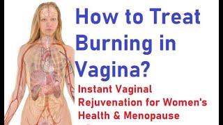 preview picture of video 'How to Treat Burning in Vagina Without Drugs'