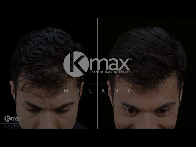 Vídeo relacionado con Fibras Capilares Castaño Oscuro 27.5 g para pérdida de cabello Spray en polvo Fibras capilares para adelgazamiento del cabello, cabello más grueso y más lleno en 15 segundos