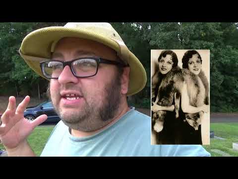 The Hilton Sisters - Notorious Conjoined Twins