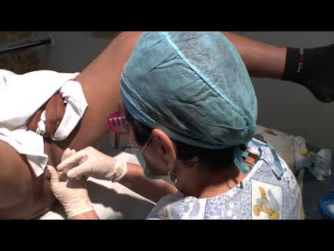 Prostatica necroscopia iperplasia TRUS prostata e come prepararla
