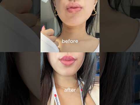 I Tried Lip Blushing and It Changed my Lips 💋 #lipblush #liptattoo #lipblushing #permanentmakeup