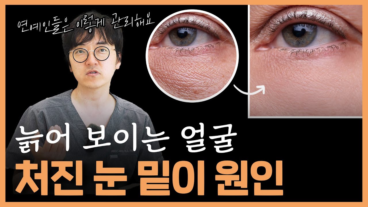 늙어 보이는 얼굴의 원인
