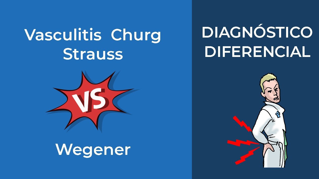 Diagnóstico Diferencial. Vasculitis  Churg Strauss vs Wegener