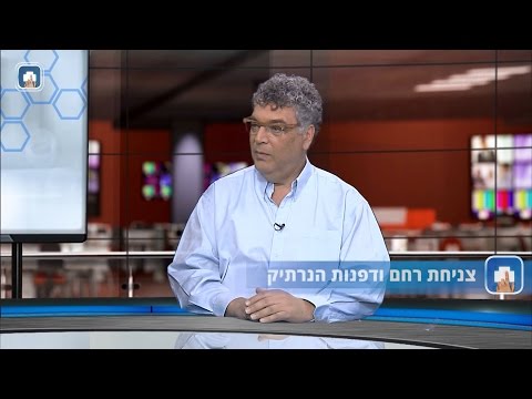 צניחת רחם ודפנות הנרתיק: המילון הרפואי