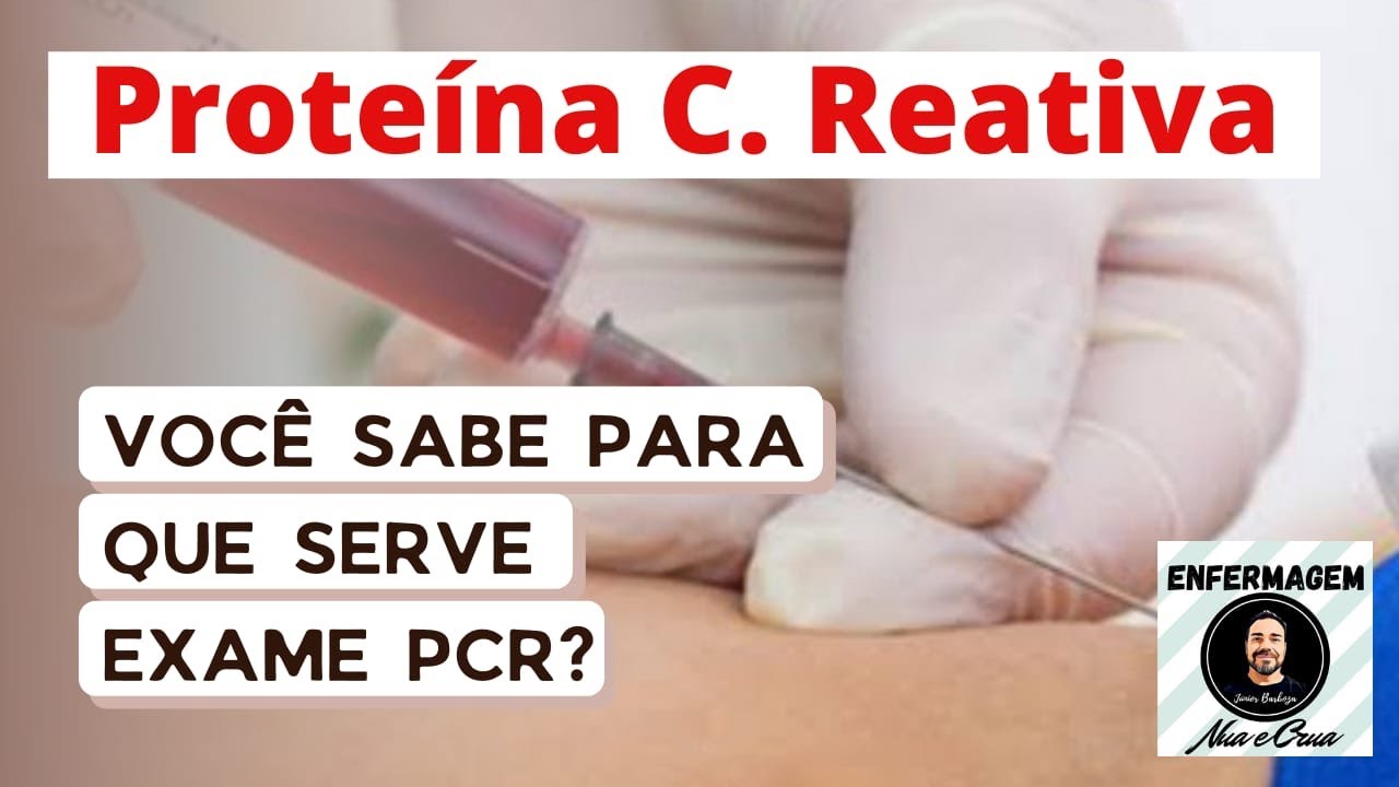 Watch Now Proteína C. Reativa - PCR Você sabe para que serve este EXAME Proteína C. Reativa - PCR Você sabe para que serve este EXAME