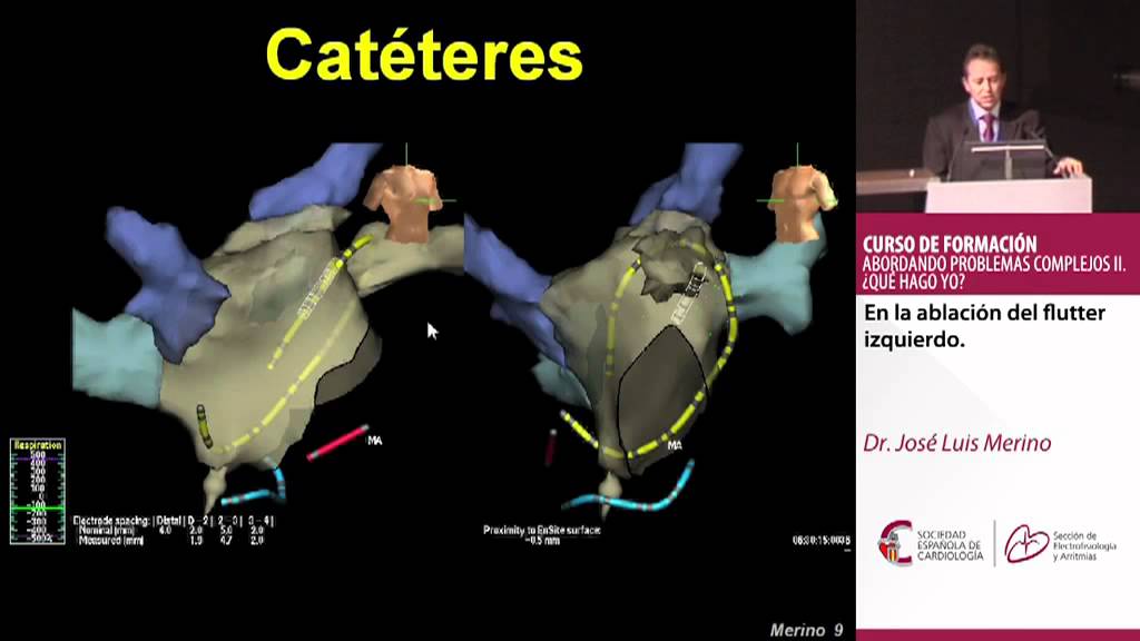 José Luis Merino Llorens-2