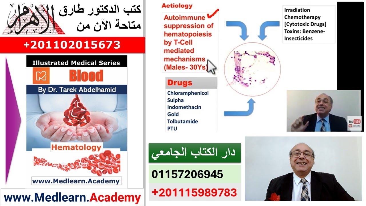 Aplastic Anemia  #cme #internal_medicine #medical #usmle #محاضرات_باطنة #USMLE