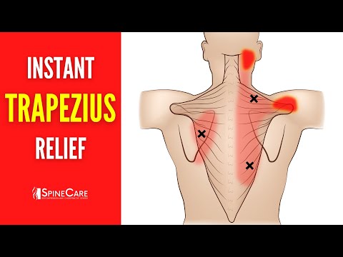 How to Relieve Trapezius Pain FOR GOOD