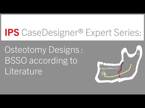 Osteotomy Designs | BSSO According To Literature | IPS CaseDesigner® Expert Series