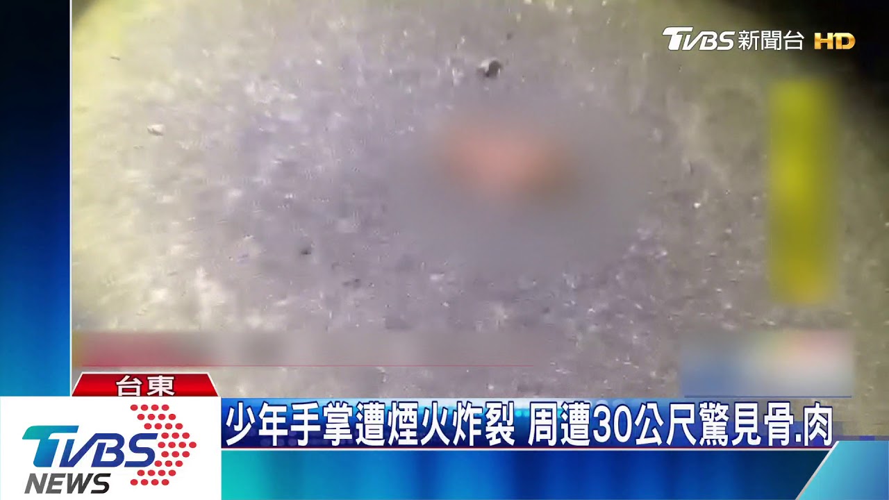 煙火炸開!17歲少年右手掌炸裂 滿地碎肉