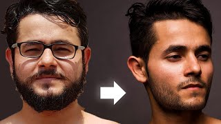 LOSE FACE FAT forever & get Jawline (1 SIMPLE SECRET) - हिन्दी