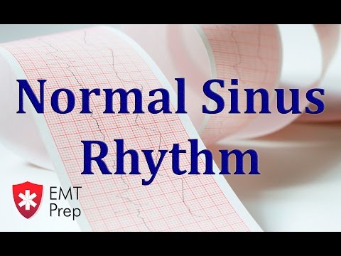 Normal Sinus Rhythm ECG - EMTprep.com