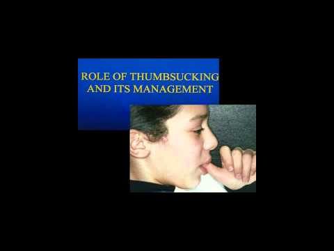 e-Den Education Webinar: Interceptive Orthodontic Treatment in the Mixed Dentition PART 2