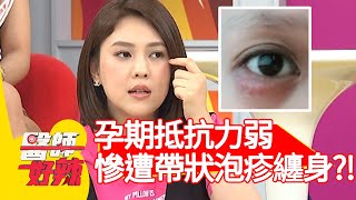 朱芯儀孕期抵抗力弱，慘遭帶狀泡疹纏身？！【醫師好辣】20200416 part2 EP929 洪永祥 朱芯儀
