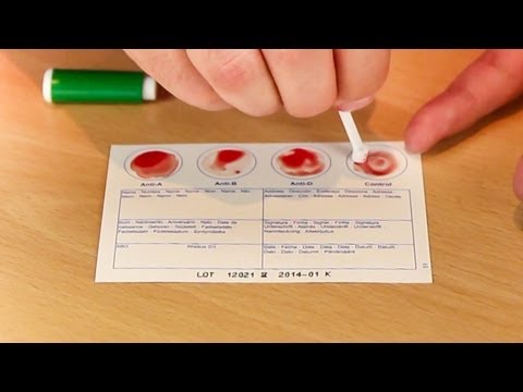 Eigene Blutgruppe per Schnelltest bestimmen