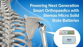  Powering Smart Orthopaedic Implants