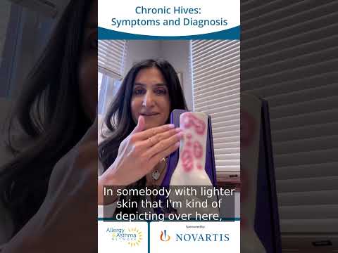 Chronic Hives: Symptoms and Diagnosis! #hives #chronichives #urticaria #chronicurticaria