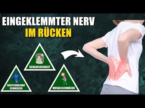 6 Anzeichen für einen eingeklemmten Nerv im Rücken