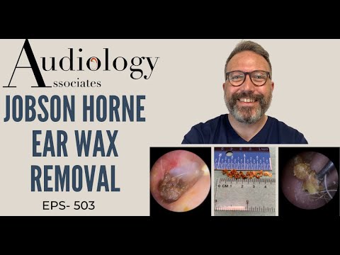 JOBSON HORNE EAR WAX REMOVAL - EP 503