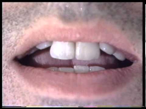 Video thumbnail for Surgery