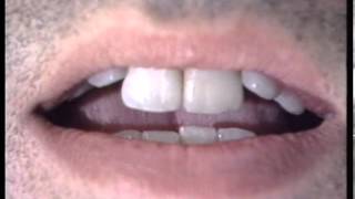 Robyn Hitchcock - Surgery - (Gotta Let This Hen Out, 1985)