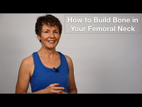 Femoral Neck Fractures and Exercise