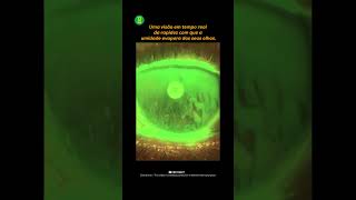 É assim que seus olhos ressecam rapidamente #humaneye #trendingshorts #science #facts