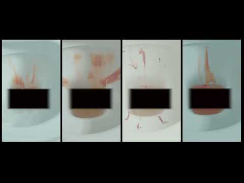 Kanser kolorektal - Misi dalam tandas  - BEAUTY & Health