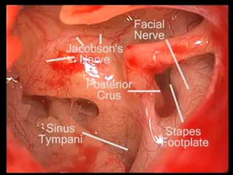 Middle Ear Endoscopy