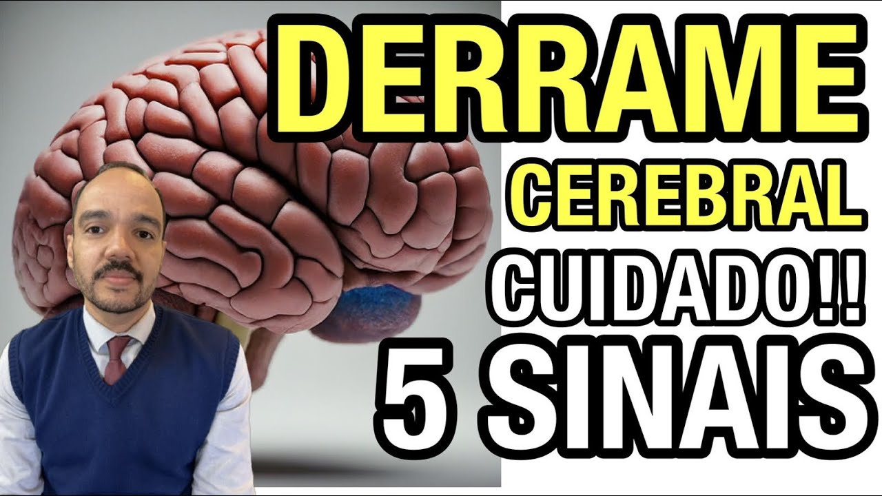 SINAIS OCULTOS DE UM DERRAME CEREBRAL