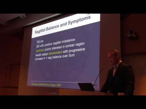 Eric Klineberg, M.D. - Spinopelvic Parameters for Adult Spinal Deformity