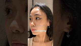 Download lagu Engene got surgery to look like Jungwon #enhypen #shorts #shortsfeed #shortsviral #kpopnews mp3