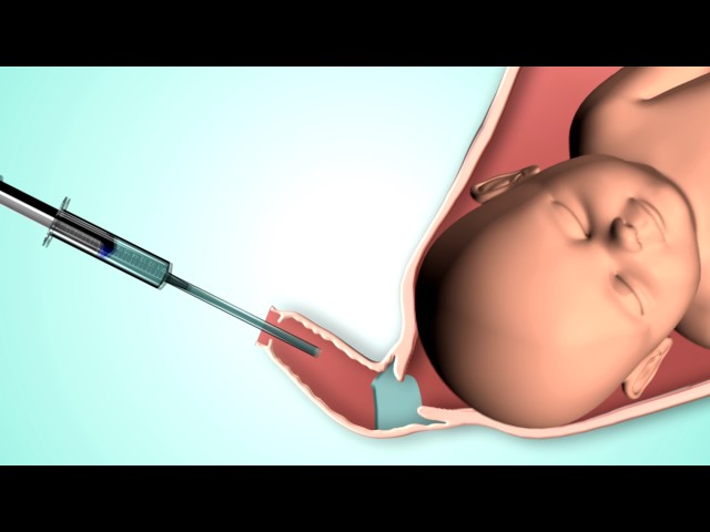 جينوتال جل الولادة