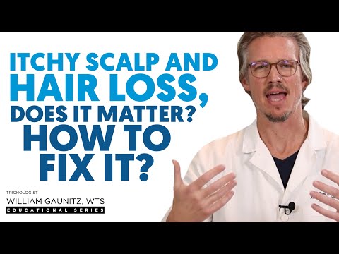 Does Dandruff Scalp Cause Hair Loss? Treatment For Dry Itchy Scalp