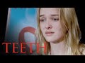 Dawn Struggles To Speak On Purity Scene Teeth