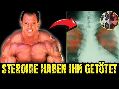 TOM PRINCE: The champion who fell apart after years of taking steroids