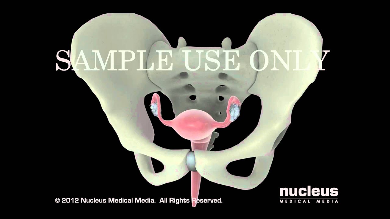 Edgar Teolotitla Rosales-8