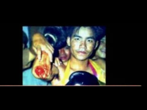 His Name Scares Me  - Yodkhunpon The Elbow Hunter of 100 Stitches: Technique Breakdown