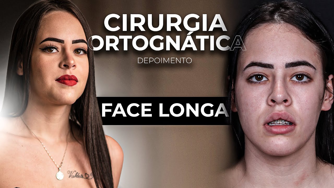 João Pedro Paulino Mazzon-78