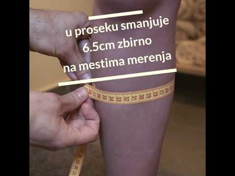 Kako skinuti celulit i nagomilane masti za butina?