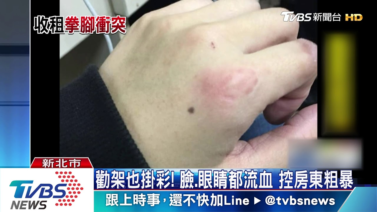 啪!房東遭控甩巴掌 租金問題爆全武行