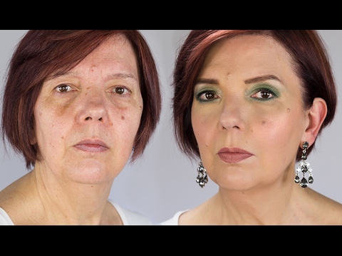 Da quello che pigmentary bianco nota su una faccia Rimedi efficaci da pigmentazione su risposte di faccia