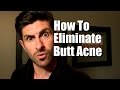 How To Eliminate Butt Acne Buttne Stop Butt Breakouts Pimples