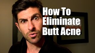 How To Eliminate Butt Acne (Buttne) | Stop Butt Breakouts & Pimples